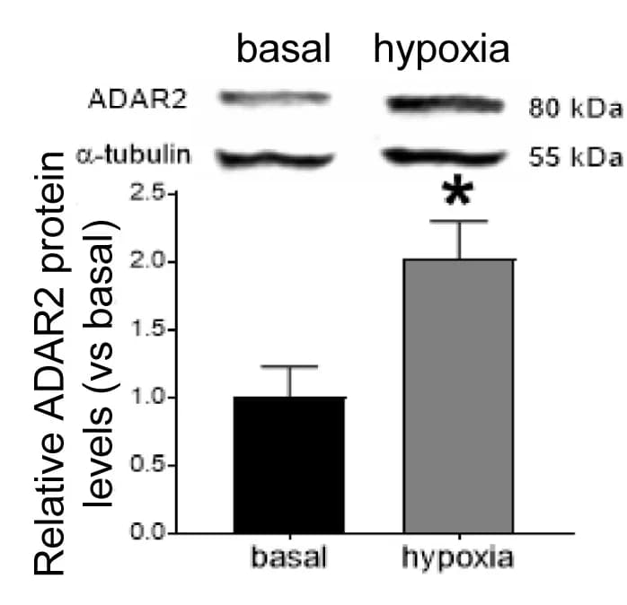 Open access visualization of Bar Plot, Error Bars, ADAR2, ADARB1, Protein Level
