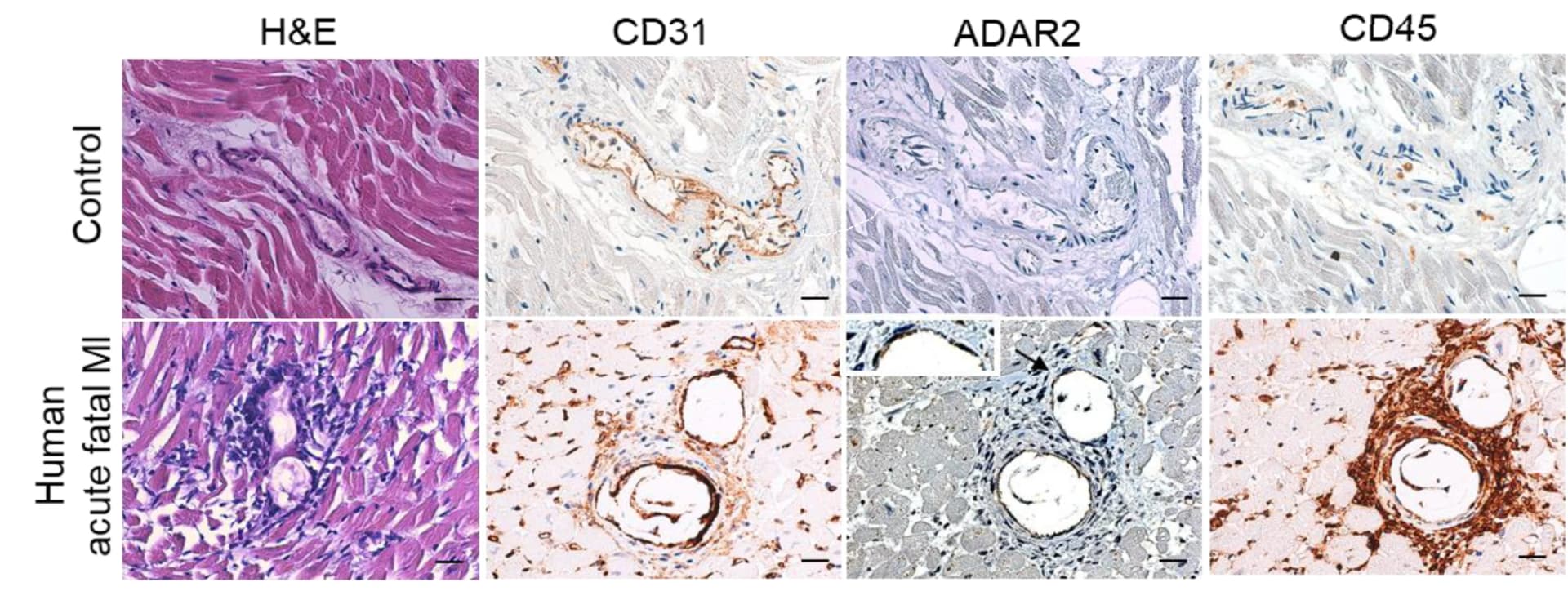 Open access visualization of Microscopy, Histological Analysis, Myocardial Tissue, Myocardial Infarction, H&E Staining