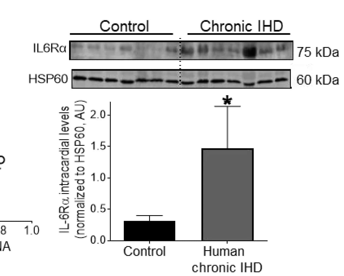 Open access visualization of Bar Plot, Error Bars, Gel, Western Blot, IL-6Rα Protein
