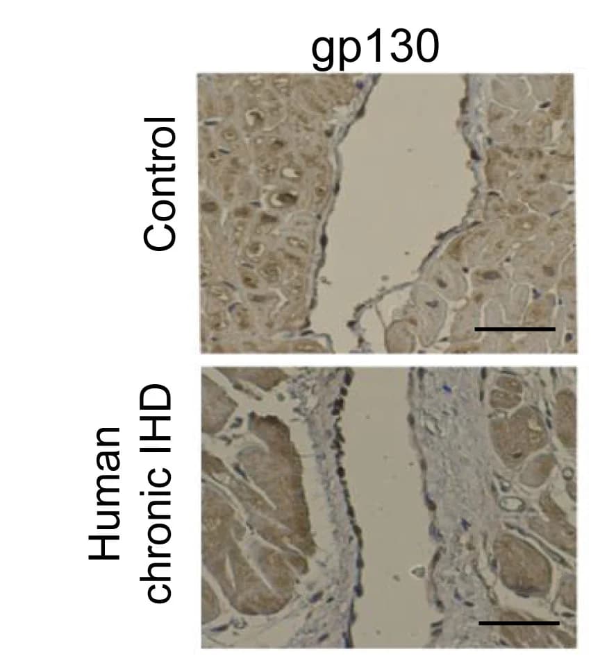 Open access visualization of Microscopy, Histology, Left Ventricle Biopsies, Chronic Ischemic Heart Disease, Control