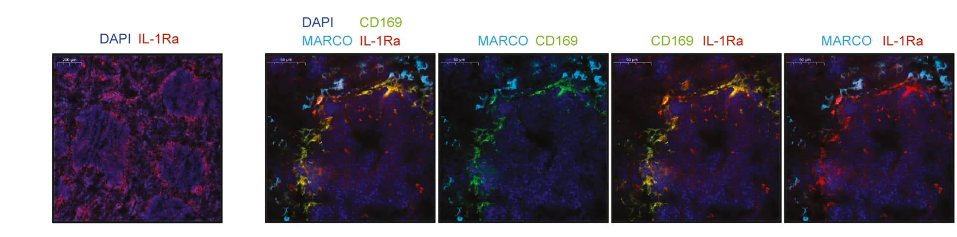 Open access visualization of Microscopy, Immunofluorescence, MARCO, CD169, IL-1Ra