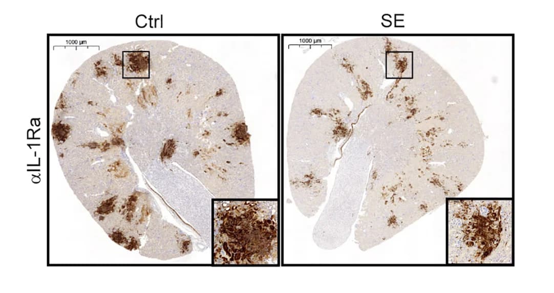 Open access visualization of Microscopy, Splenectomized mice, Control mice, Day 3 p.i., IL-1Ra staining