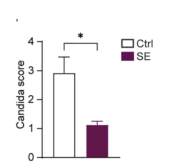 Open access visualization of Bar Plot, Error Bars, Histopathology, Fungal dissemination