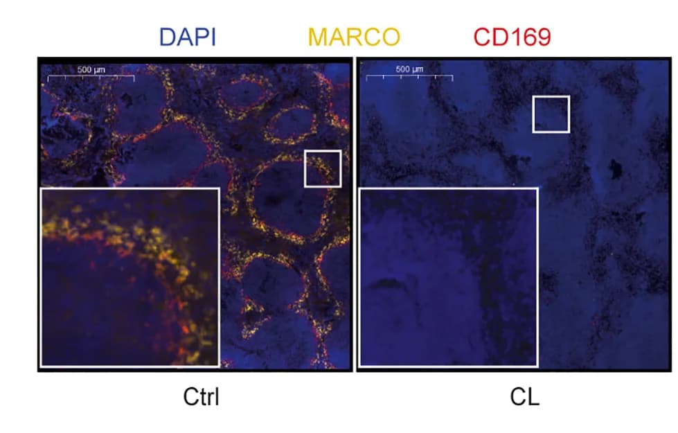 Open access visualization of Microscopy, Clodronate liposomes, Control mice, Day 3 p.i., Macrophage depletion