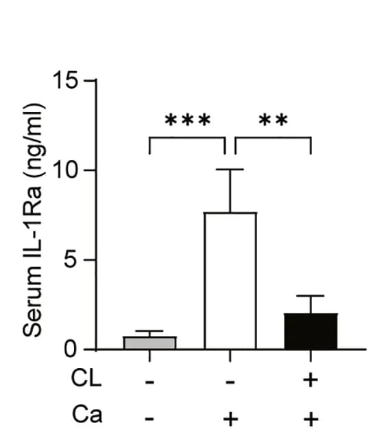 Open access visualization of Bar Plot, Error Bars, Clodronate liposomes, Control mice, Day 3 p.i.