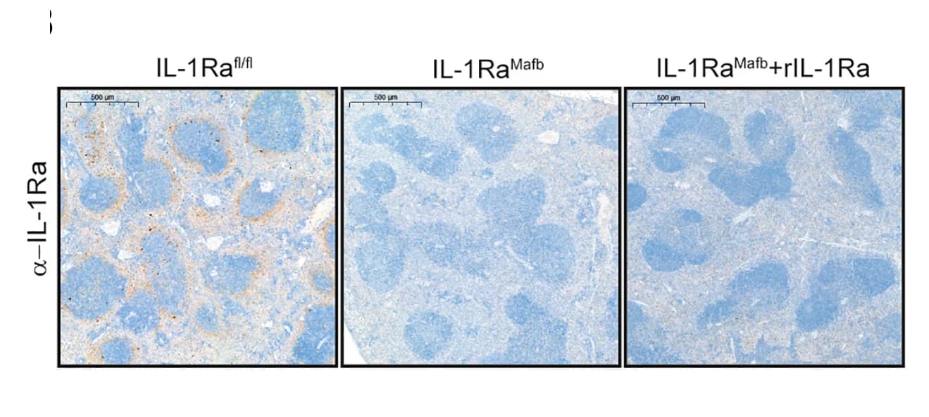 Open access visualization of Microscopy, IL-1Ra reconstitution, Spleen, Candida infection, Mice
