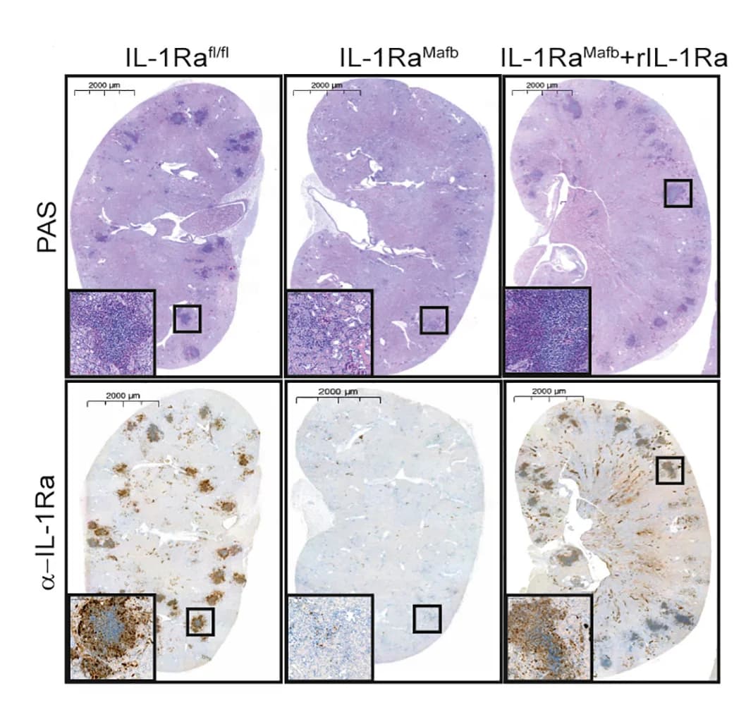 Open access visualization of Microscopy, IL-1Ra-reconstituted, PAS staining, IL-1Ra staining, Kidney