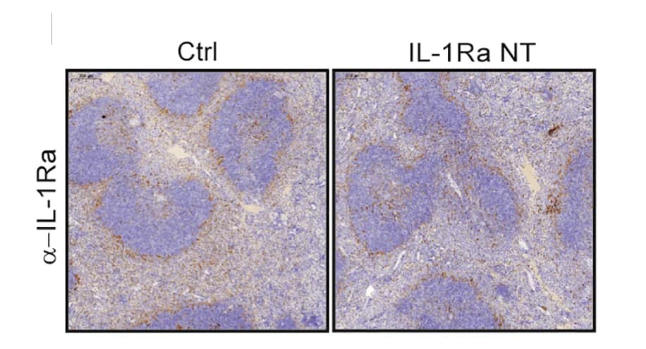 Open access visualization of Microscopy, IL-1Ra Neutralization, IL-1Ra expression, Spleen, Candida infection