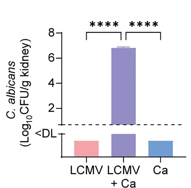 Open access visualization of Bar Plot, Error Bars, PIC, IL-1Ra, Spleen