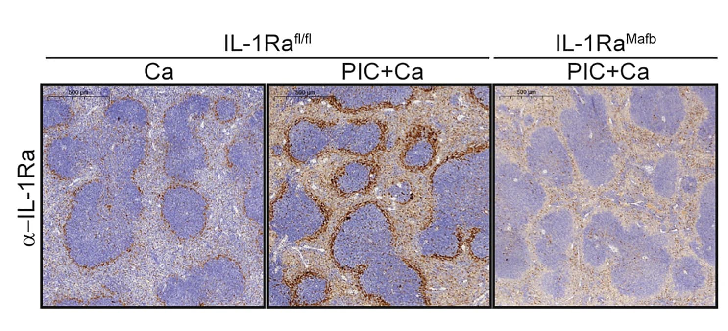 Open access visualization of Microscopy, PIC, IL-1Ra, Spleen, Candida infection
