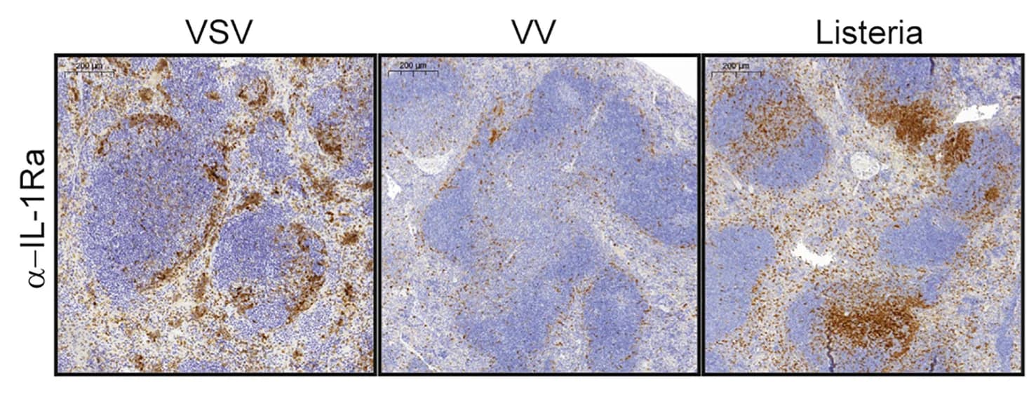 Open access visualization of Microscopy, IL-1Ra staining, Spleen, Pathogens