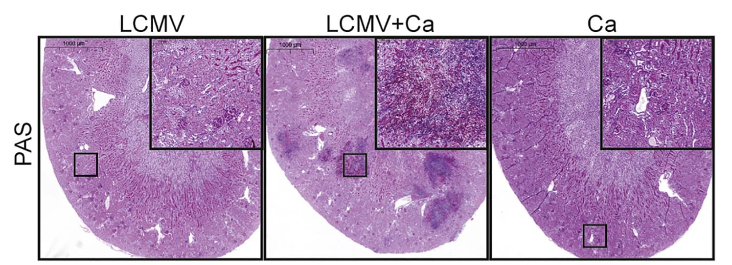 Open access visualization of Microscopy, Co-infected Mice, PAS staining, Kidney