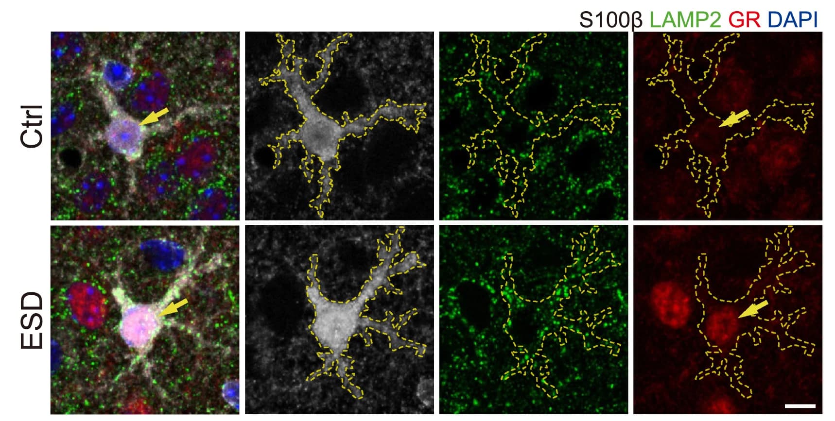Open access visualization of Microscopy, Confocal Microscopy, Z Stack Images, GR, Lysosomes