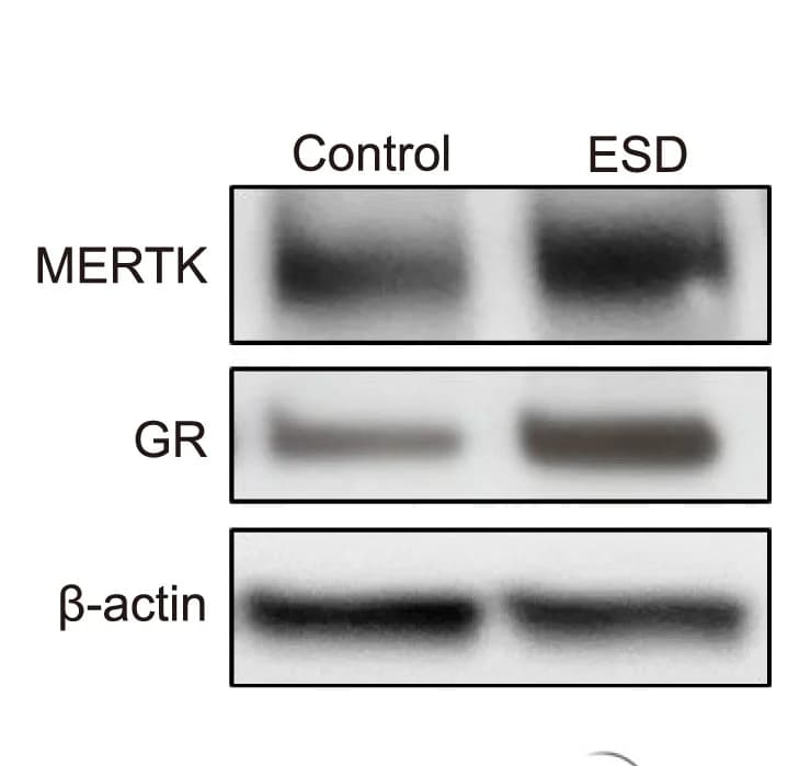 Open access visualization of Gel, Western Blot, Bar Graphs, MERTK, GR