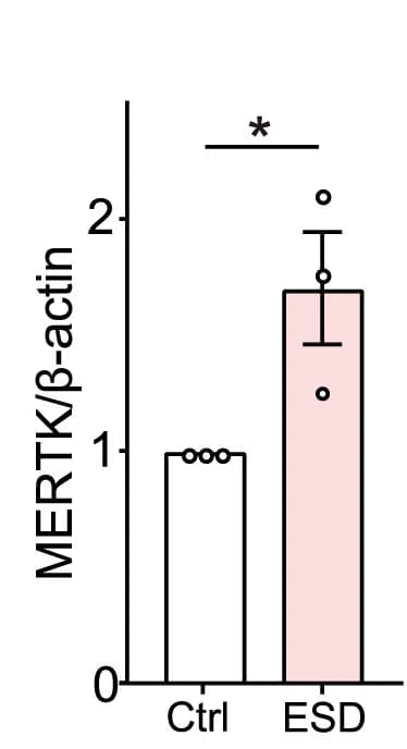 Open access visualization of Bar Plot, Error Bars, Western Blot, Bar Graphs, MERTK