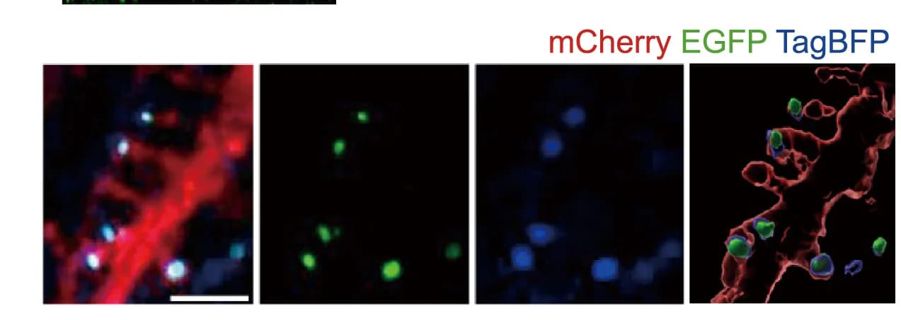Open access visualization of Microscopy, Confocal Microscopy, Z Stack Images, 3D Reconstruction, PSD951,2-tagBFP-EGFP