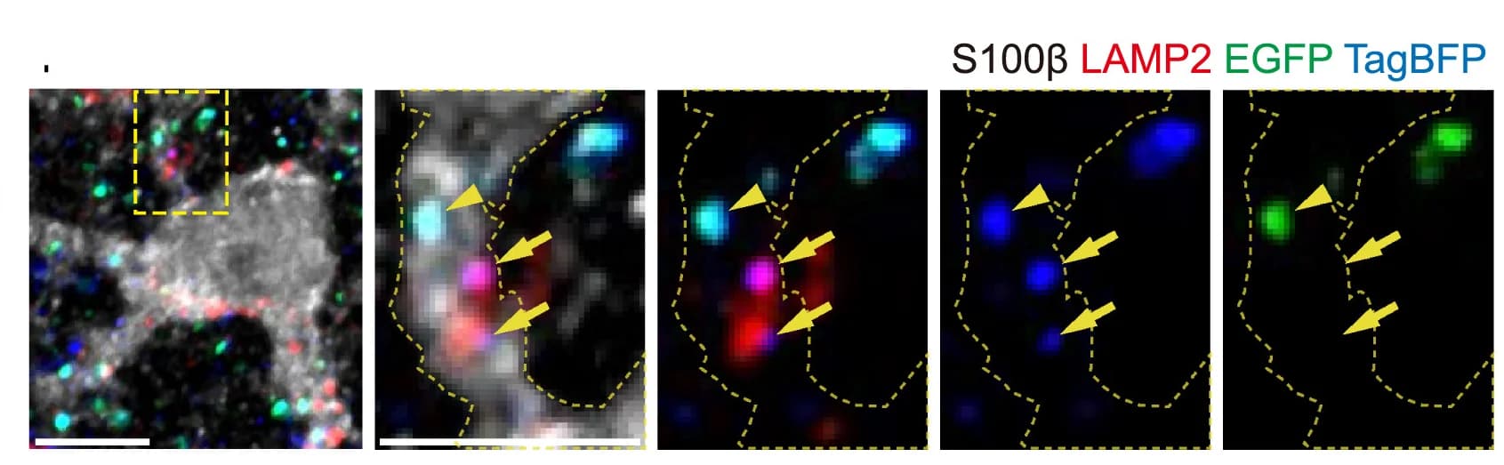 Open access visualization of Microscopy, Confocal Microscopy, Z Stack Images, Magnified Images, Phagocytosis