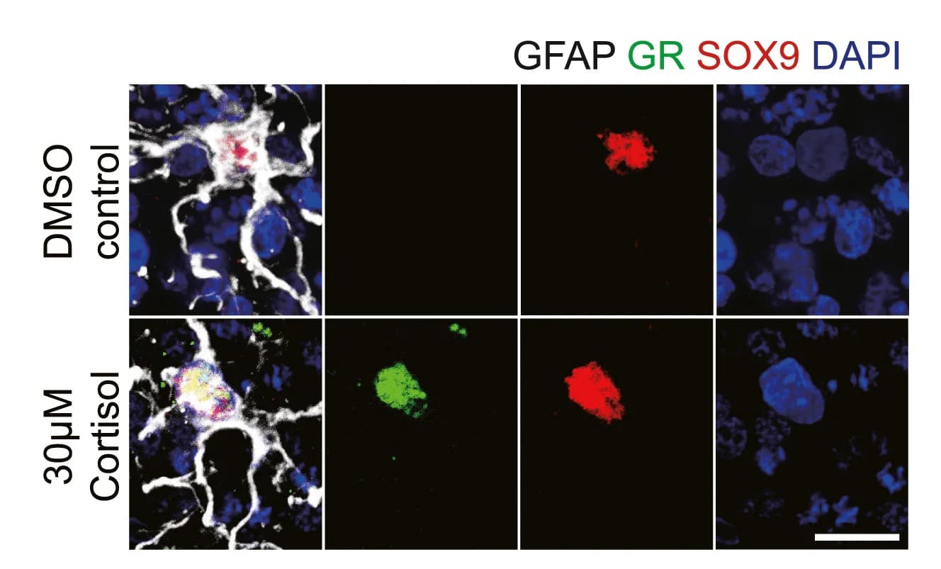 Open access visualization of Microscopy, Confocal Z Stack Images, GR Activation, Nucleus, Astrocyte