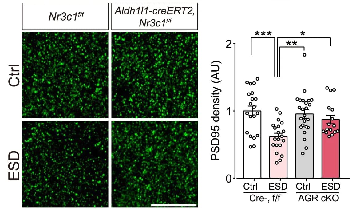 Open access visualization of Bar Plot, Scatter Plot, Error Bars, Confocal Images, PSD95