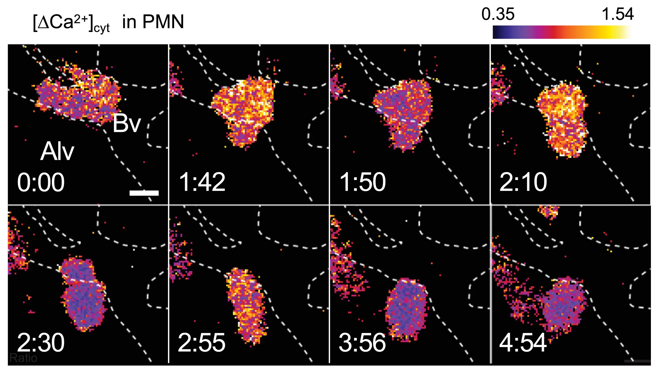 Open access visualization of Microscopy, PMNs, Calcium Transients, Lung, Microvessels