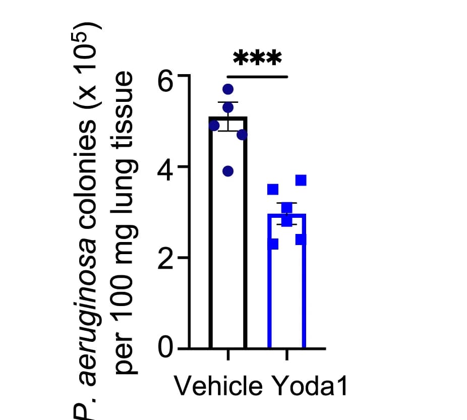 Open access visualization of Bar Plot, Error Bars, Mice, PMNs, Yoda1