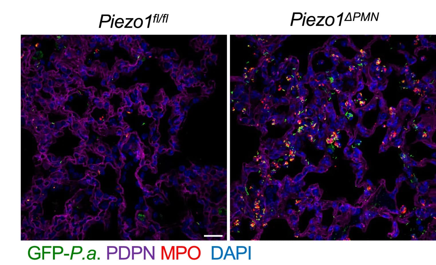 Open access visualization of Microscopy, Lung Sections, GFP-Pseudomonas Aeruginosa, Podoplanin, Tissue Architecture