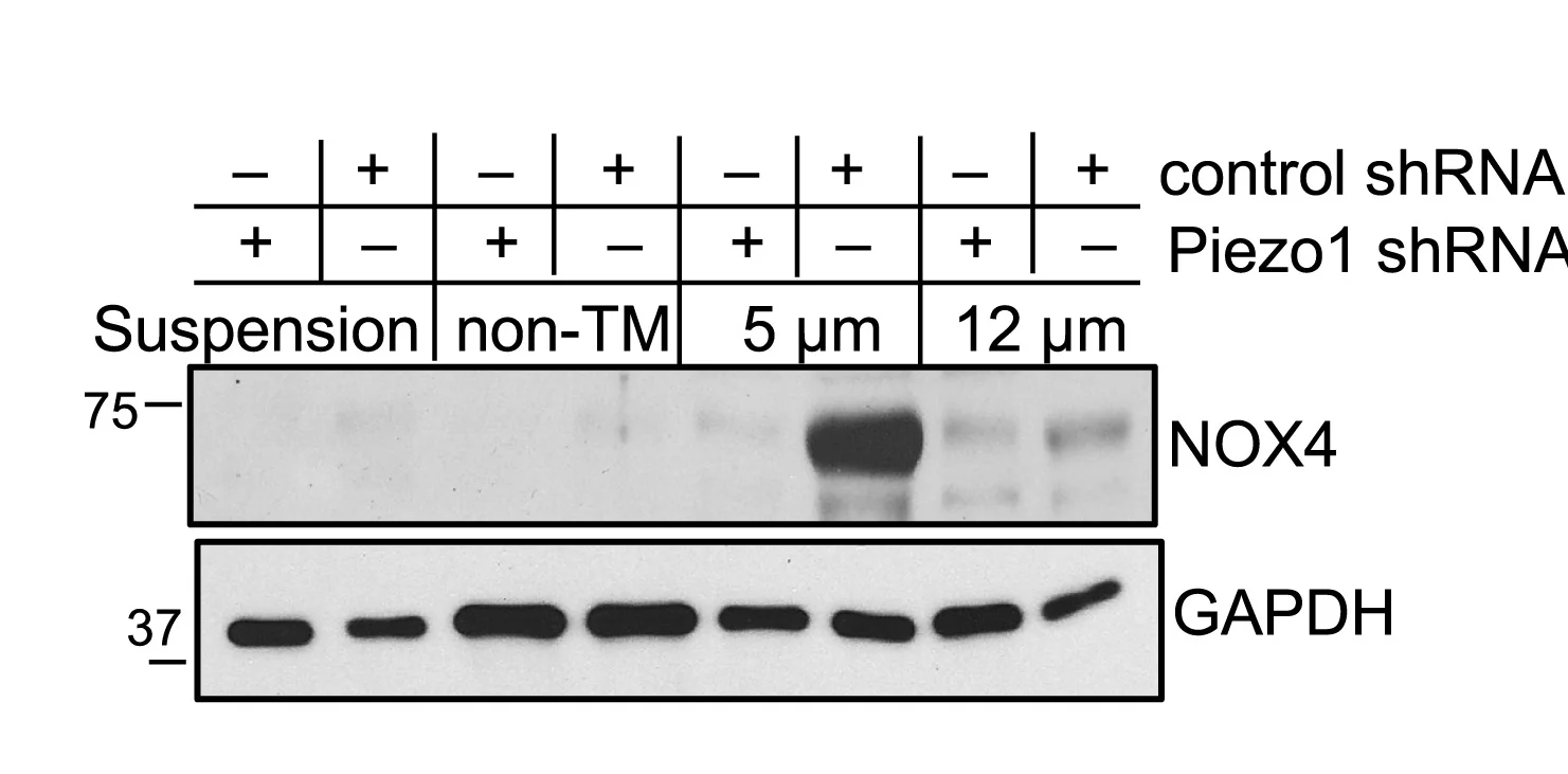 Open access visualization of Gel, NOX4, Protein Expression, HL-60 Cells, Neutrophils