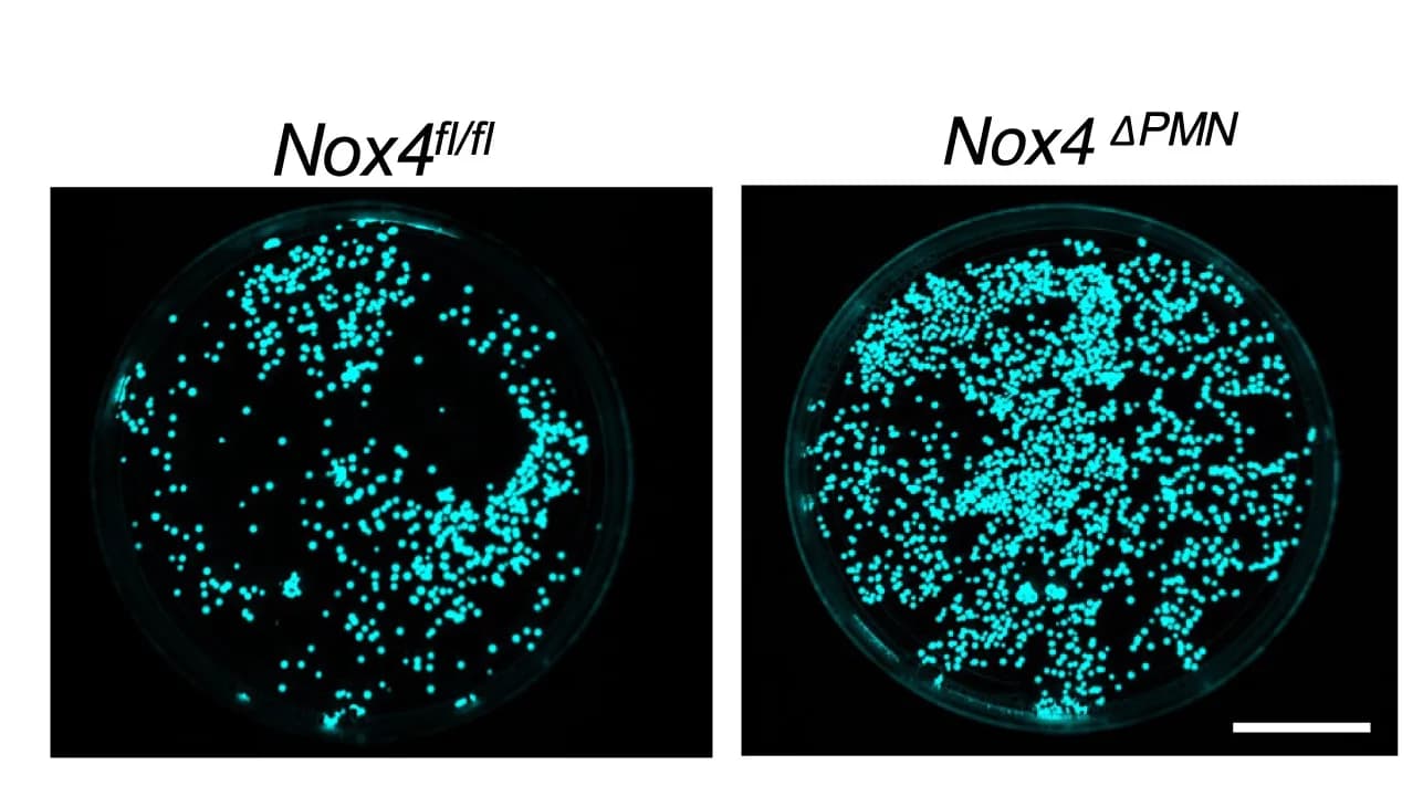 Open access visualization of Microscopy, Bacterial Clearance, Lung, NOX4, Pseudomonas aeruginosa