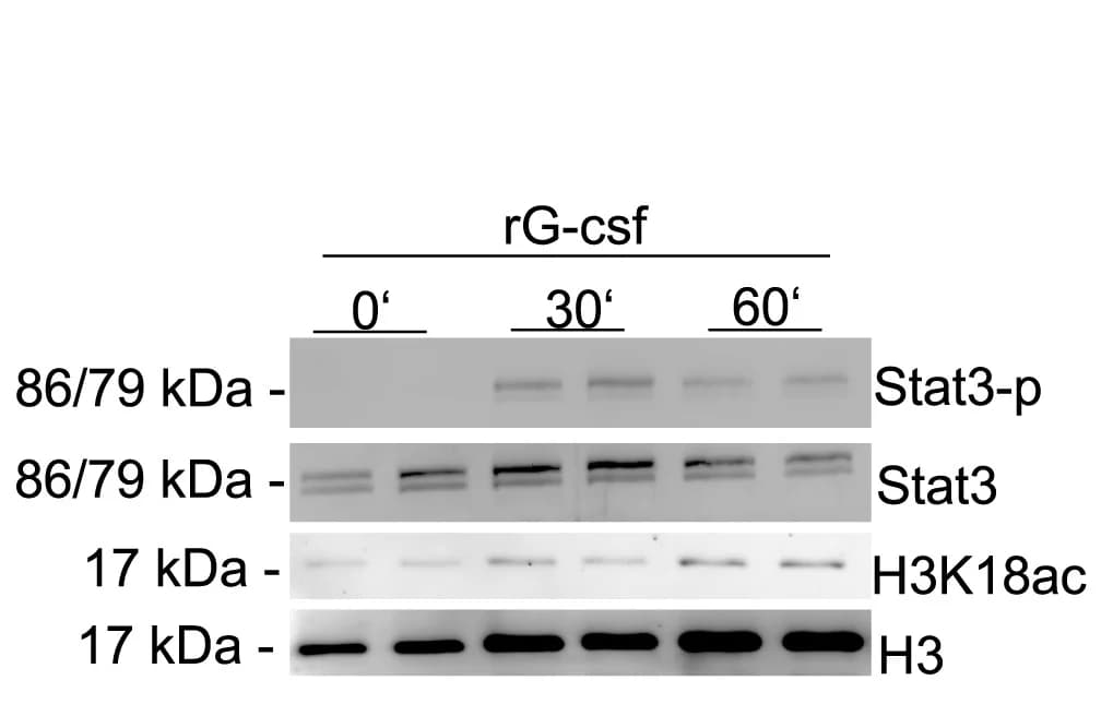 Open access visualization of Gel, Immunoblot, Acetylated Lysine 18, Histone H3, Bone Marrow Cultures