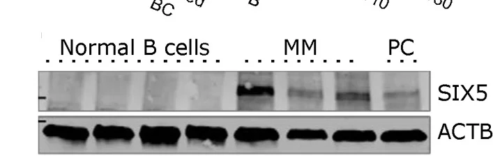 Open access visualization of Gel, Western Blot, SIX5 Protein Levels, Normal B Cells, Multiple Myeloma Cell Lines