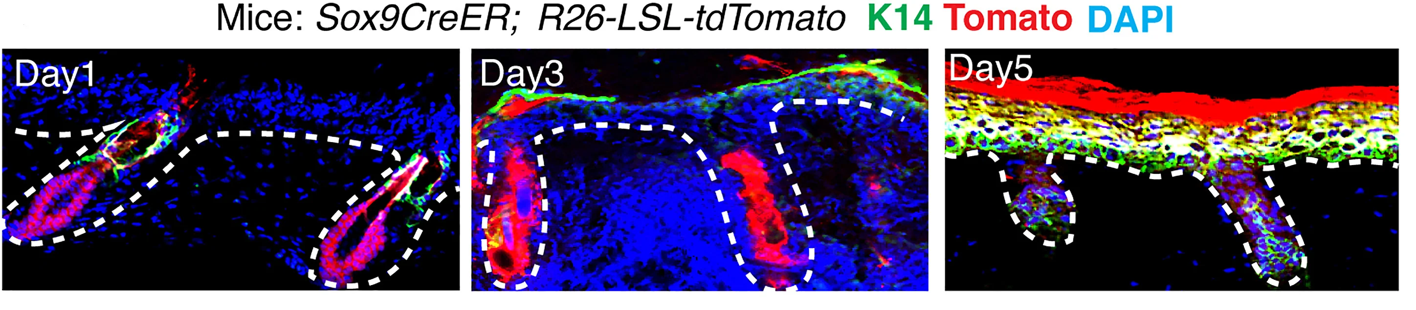 Open access visualization of Microscopy, Immunofluorescence, Sagittal Sections, Partial-Thickness Wounds, Sox9+HFSCs