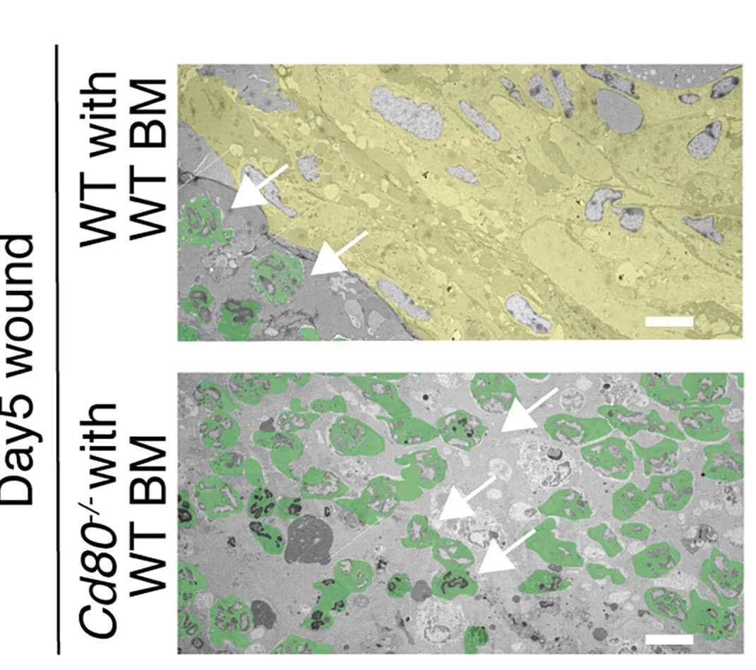 Open access visualization of Microscopy, Ultrastructural Images, Wounded Skin, WT, Cd80-/- Mice