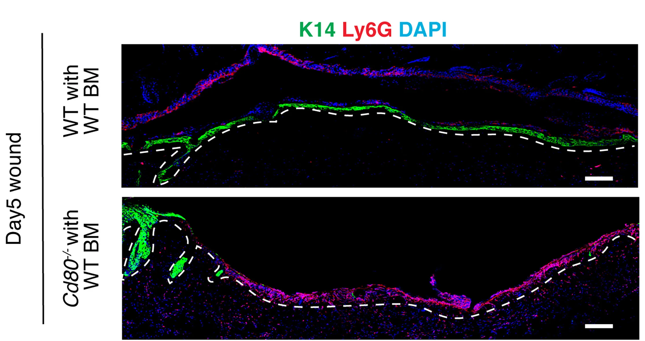 Open access visualization of Microscopy, IF Images, Ly6G+ Neutrophils, Wounded Skin, WT