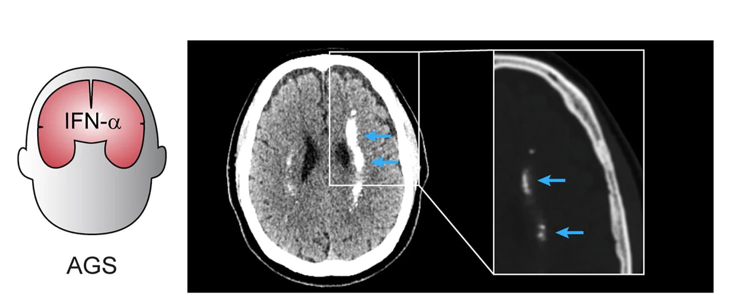 Open access visualization of Microscopy, Illustration, Computed Tomography, CT Brain Image, AGS
