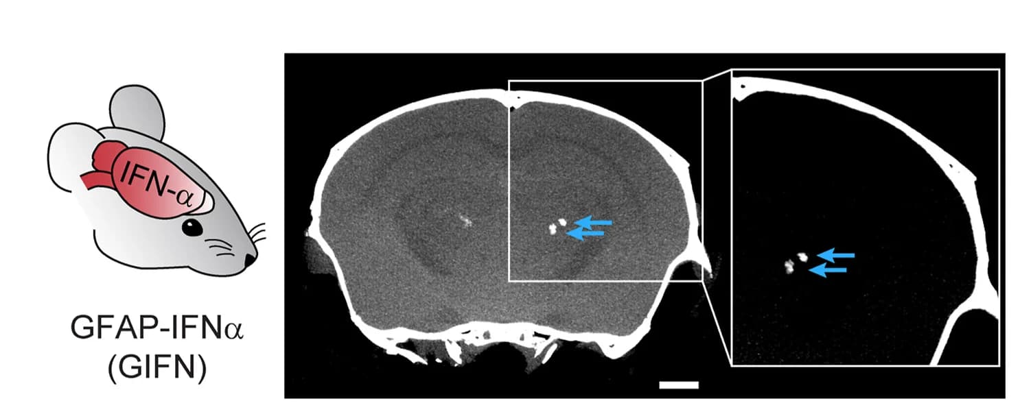 Open access visualization of Microscopy, Illustration, Micro-CT, GIFN Mouse, Bilateral Intracerebral Calcification