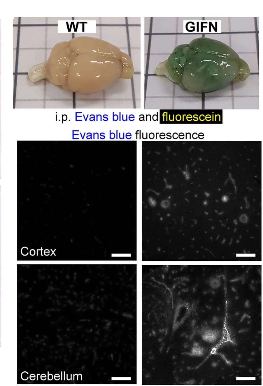 Open access visualization of Microscopy, Photo, Evans Blue, Fluorescein, WT Mice