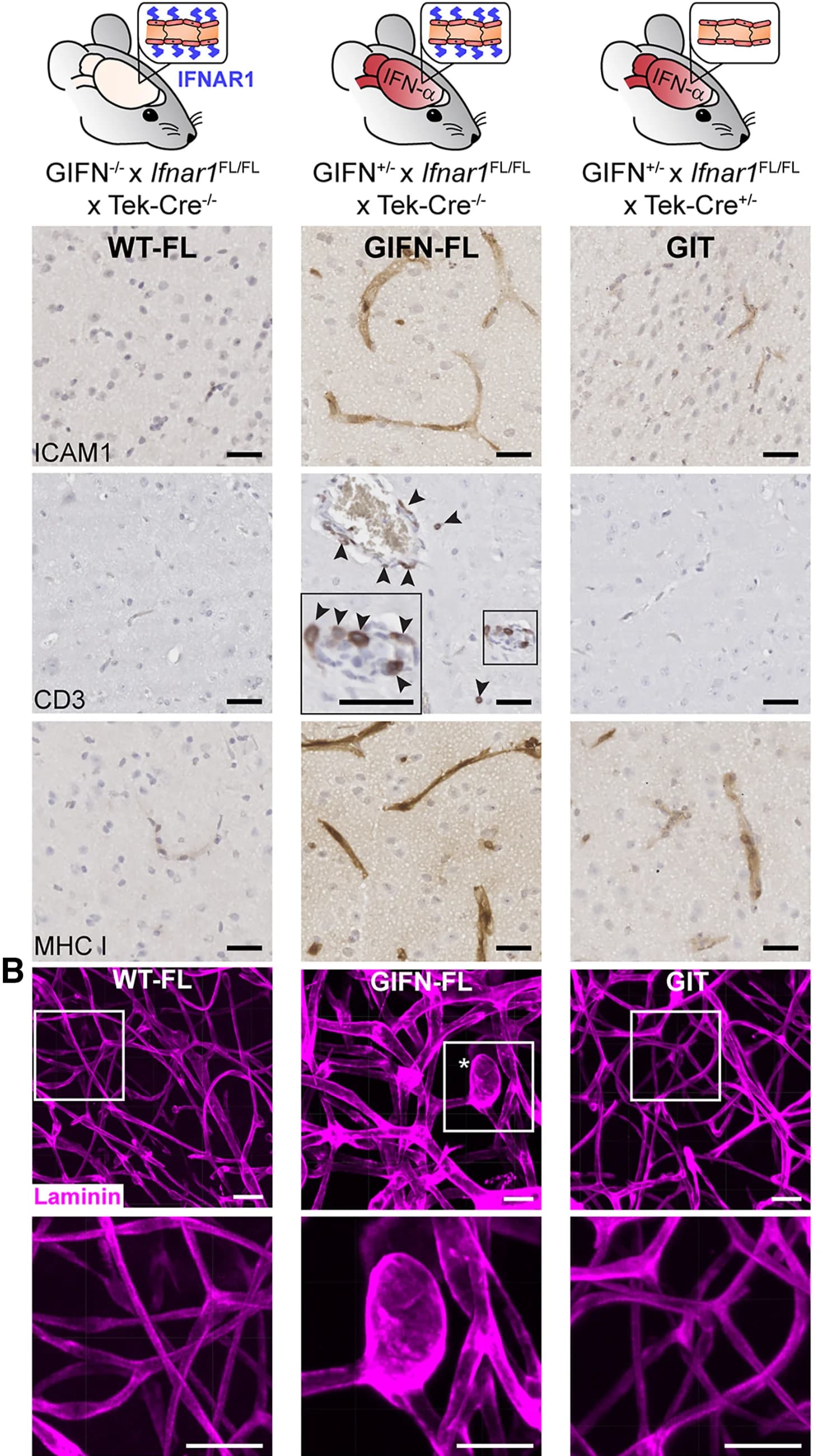Open access visualization of Microscopy, Immunohistochemistry, Endothelial Activation Marker ICAM1, CD3-Positive T Cells, MHC Class I