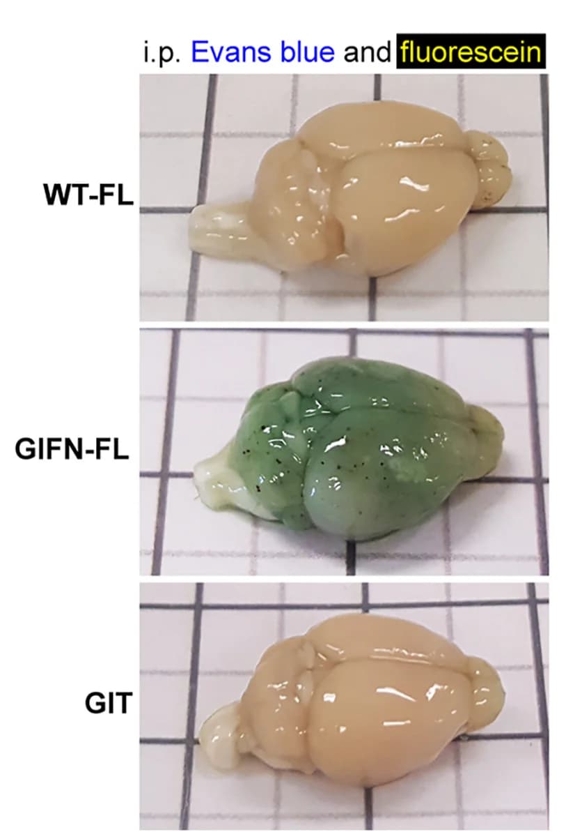 Open access visualization of Photo, Evans Blue, Fluorescein, Brain, Circulation