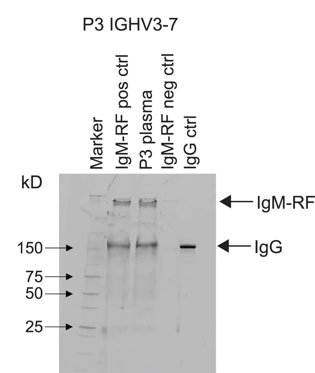 Open access visualization of Gel, Heat Aggregated IgG, Plasma, Patient Sample, SDS-PAGE