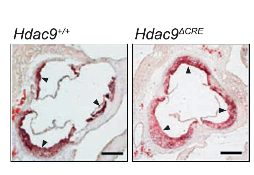 Open access visualization of Microscopy, Mice, Chow Diet, Aortic Root Plaques, Oil Red O Staining