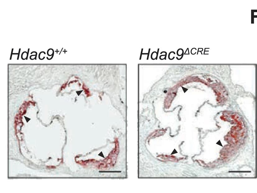 Open access visualization of Microscopy, Oil Red O Staining, Aortic Root Plaques