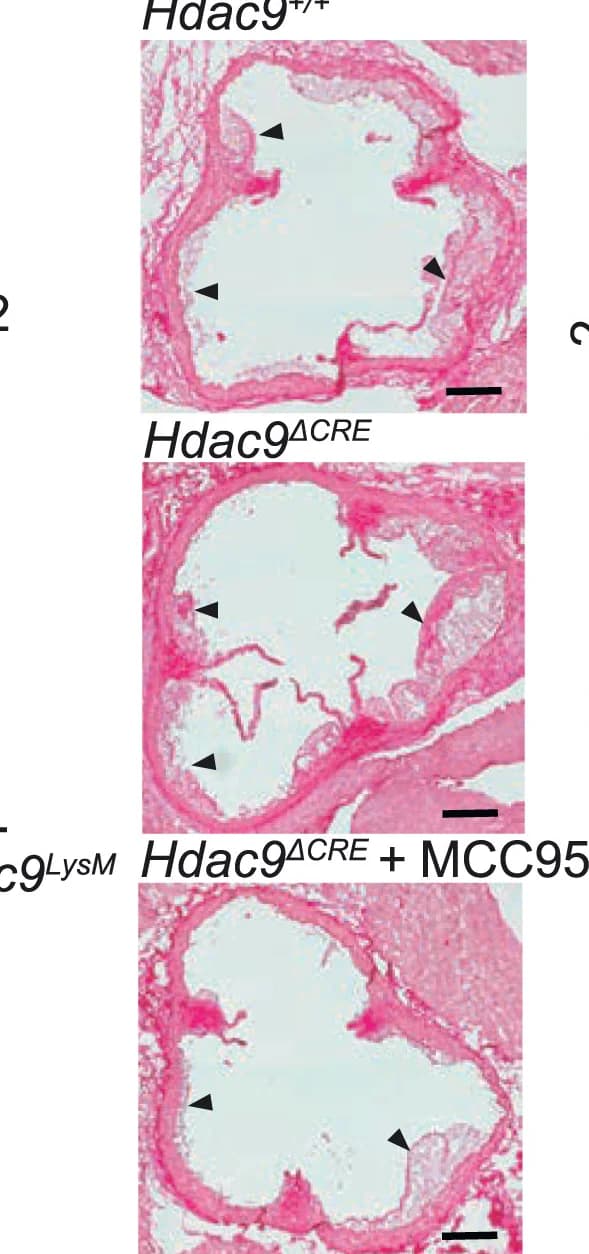Open access visualization of Microscopy, Aortic Root Plaques, Picro-Sirius Red Stain