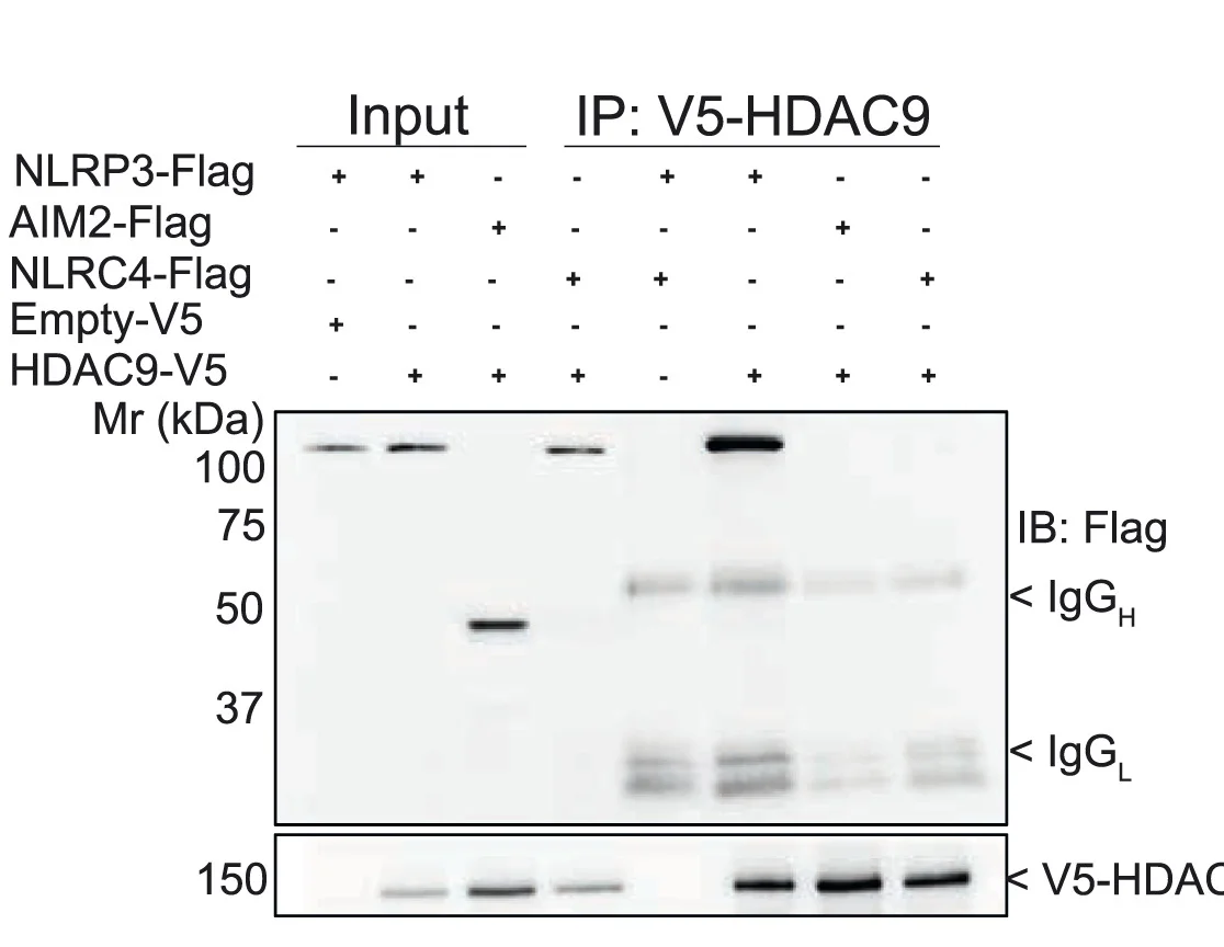Open access visualization of Gel, HEK293 Cells, Transfection, Immunoblot, HDAC9