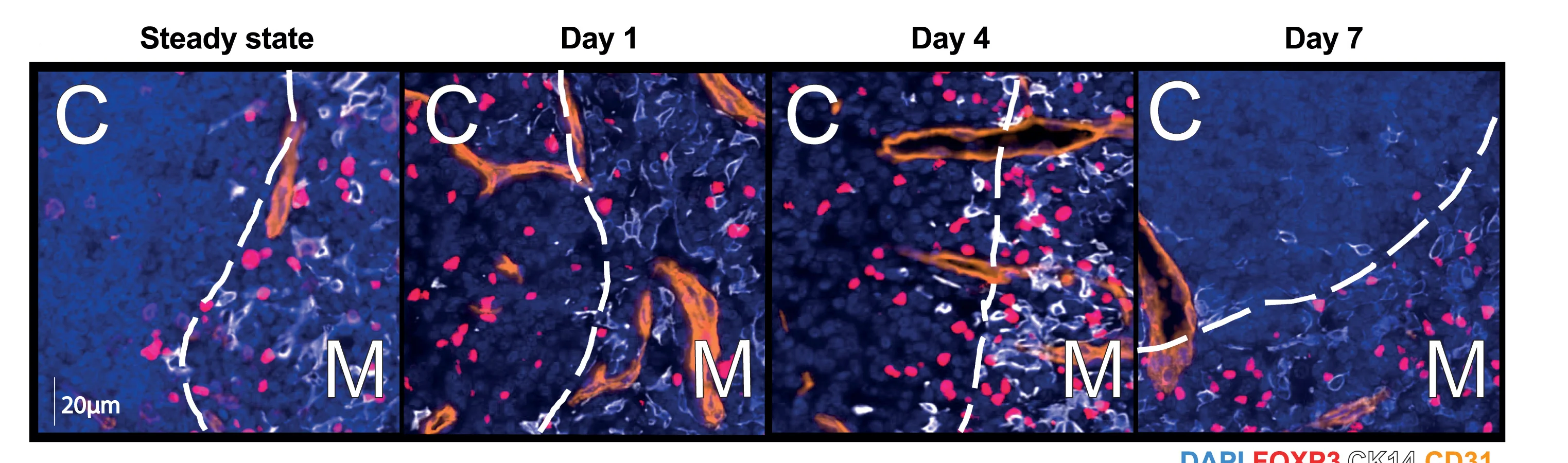 Open access visualization of Microscopy, Immunofluorescence Microscopy, Thymic Sections, Steady State, Foxp3-expressing Treg Cells