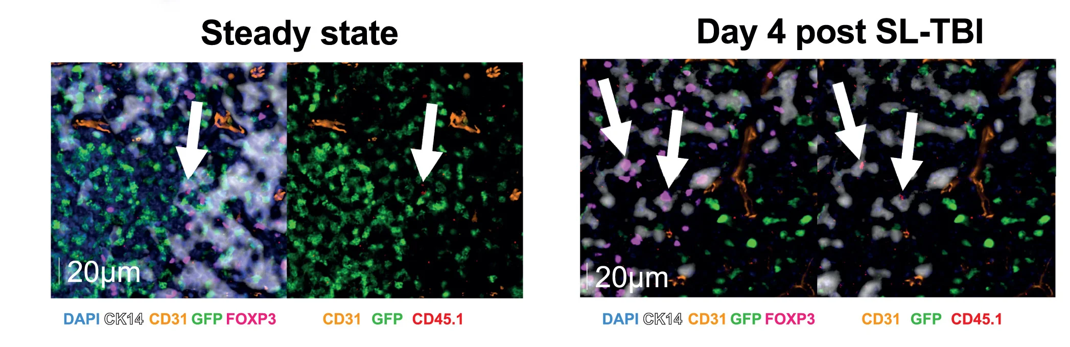 Open access visualization of Microscopy, Immunofluorescence Microscopy, GFP Co-expression, Foxp3-expressing Cells, Thymic Sections