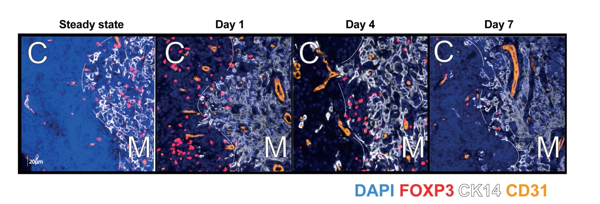 Open access visualization of Microscopy, Immunofluorescence Microscopy, Thymus, Treg Cells, Foxp3