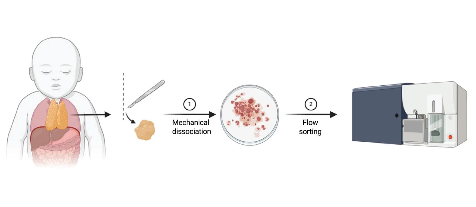 Open access visualization of Workflow, Thymic Sampling, Children, Open-Heart Surgeries