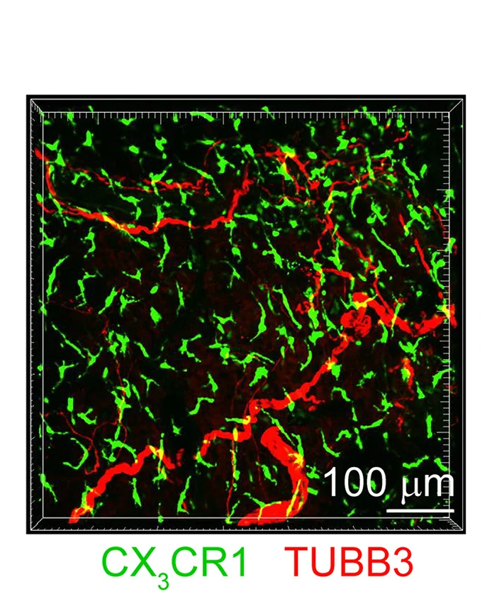 Open access visualization of Microscopy, Whole-Mount Staining, CX3CR1hi Macrophages, TUBB3+ Nerve Bundles