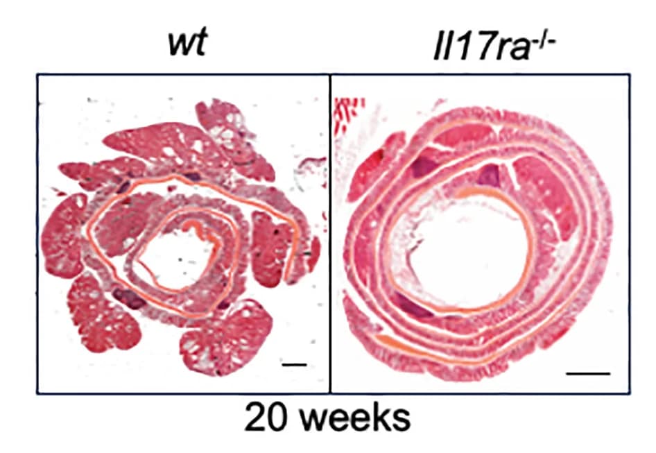 Open access visualization of Microscopy, Colons, Wild-Type Mice, Il17ra-/- Mice, AOM Treatment