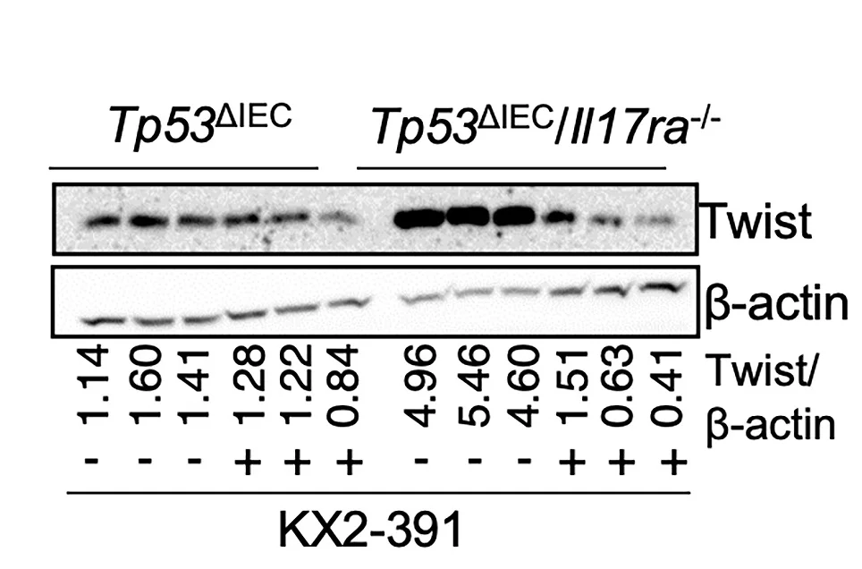Open access visualization of Gel, Twist, Beta-actin, p53ΔIEC Tumor Organoids, p53ΔIEC/Il17ra−/− Tumor Organoids